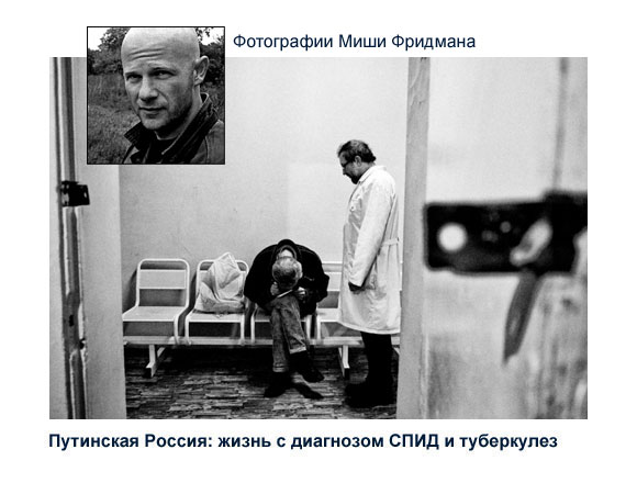 Путинская Россия: жизнь с диагнозом СПИД и туберкулез